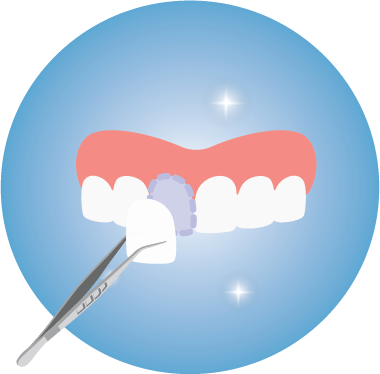 https://dentaltotalclinic.com/wp-content/uploads/2020/08/Carillas.png